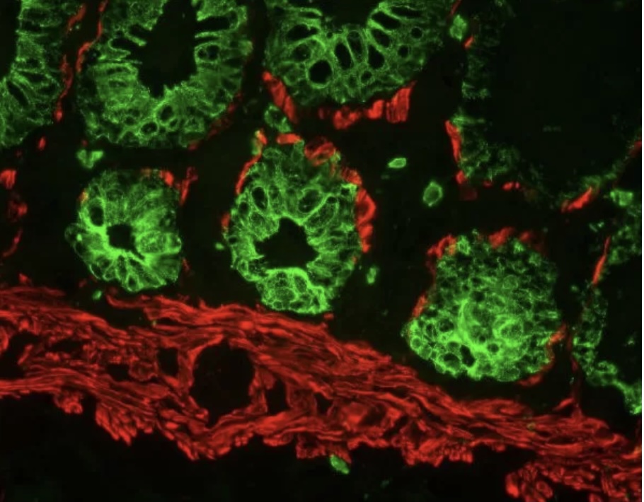 Vectorlabs M.O.M (Mouse on Mouse) 内源性小鼠Ig封闭试剂 1ml